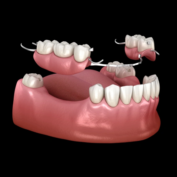 Dentures & Bridges