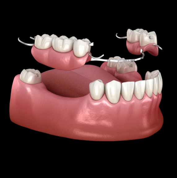 Dentures & Bridges