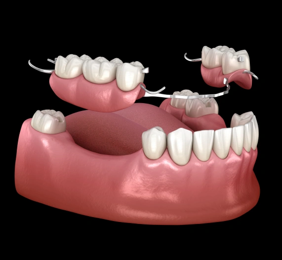 Dentures & Bridges