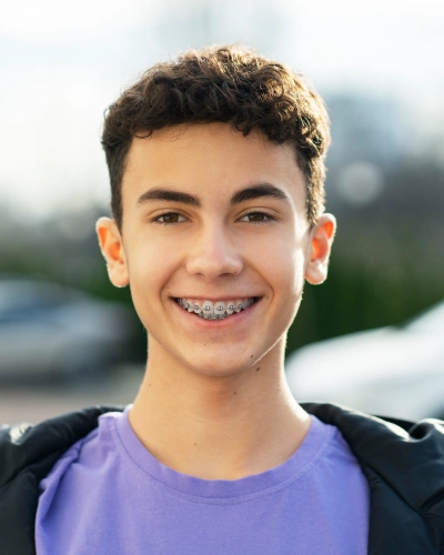 Braces for Teens