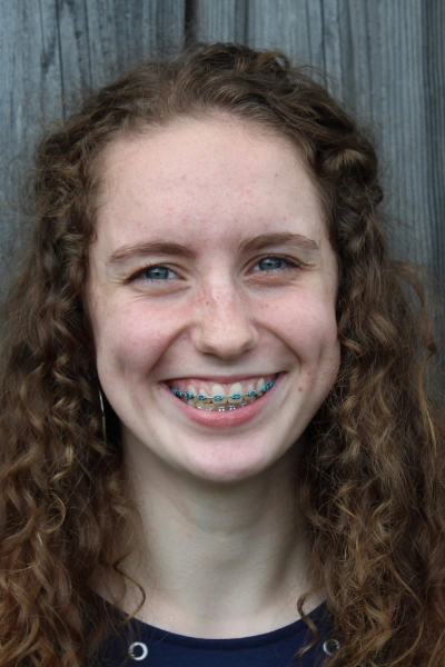 Braces for Adults