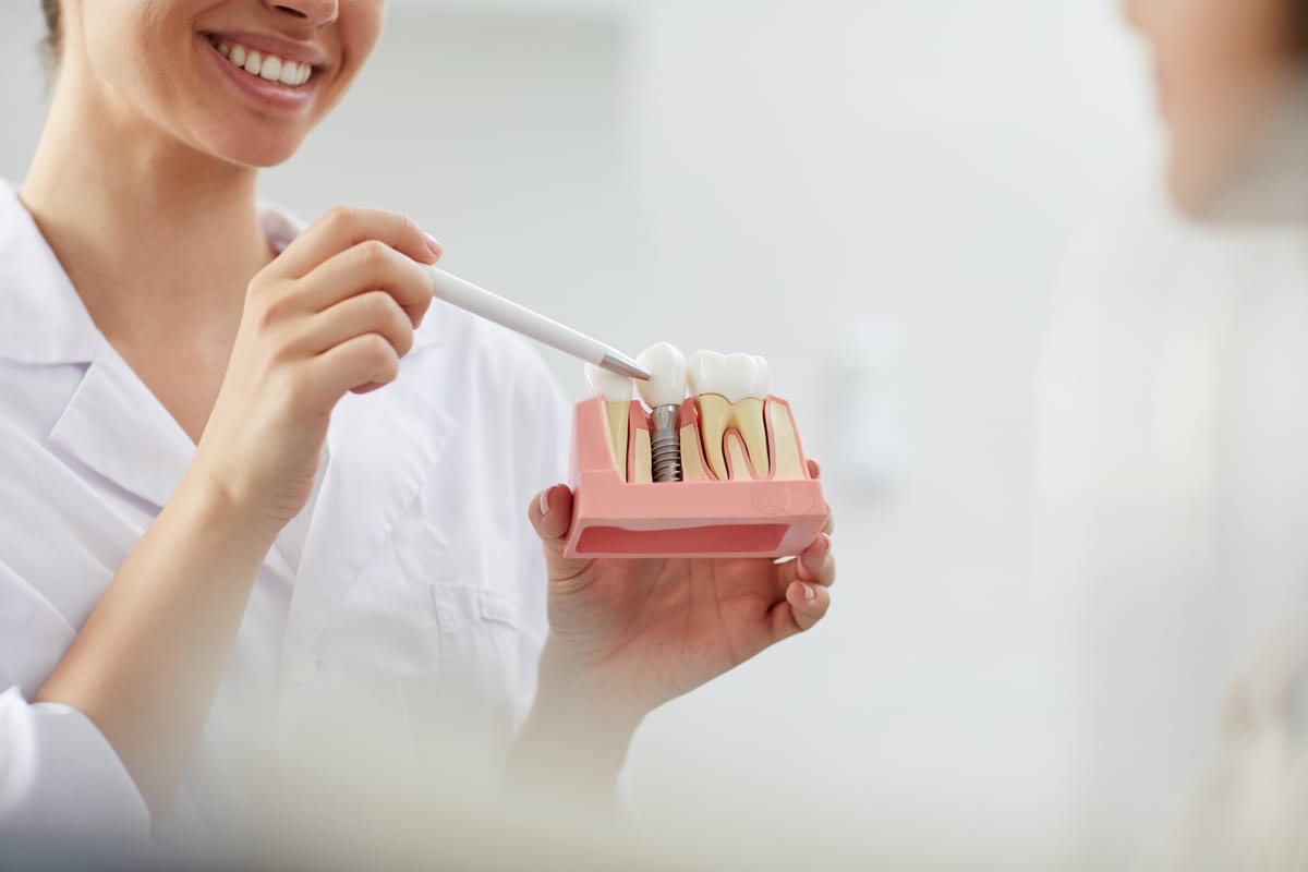 Dental Implants in Bryan