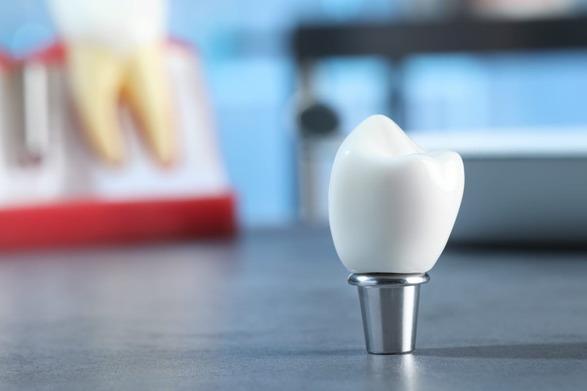 Restorative Dentistry in College Station