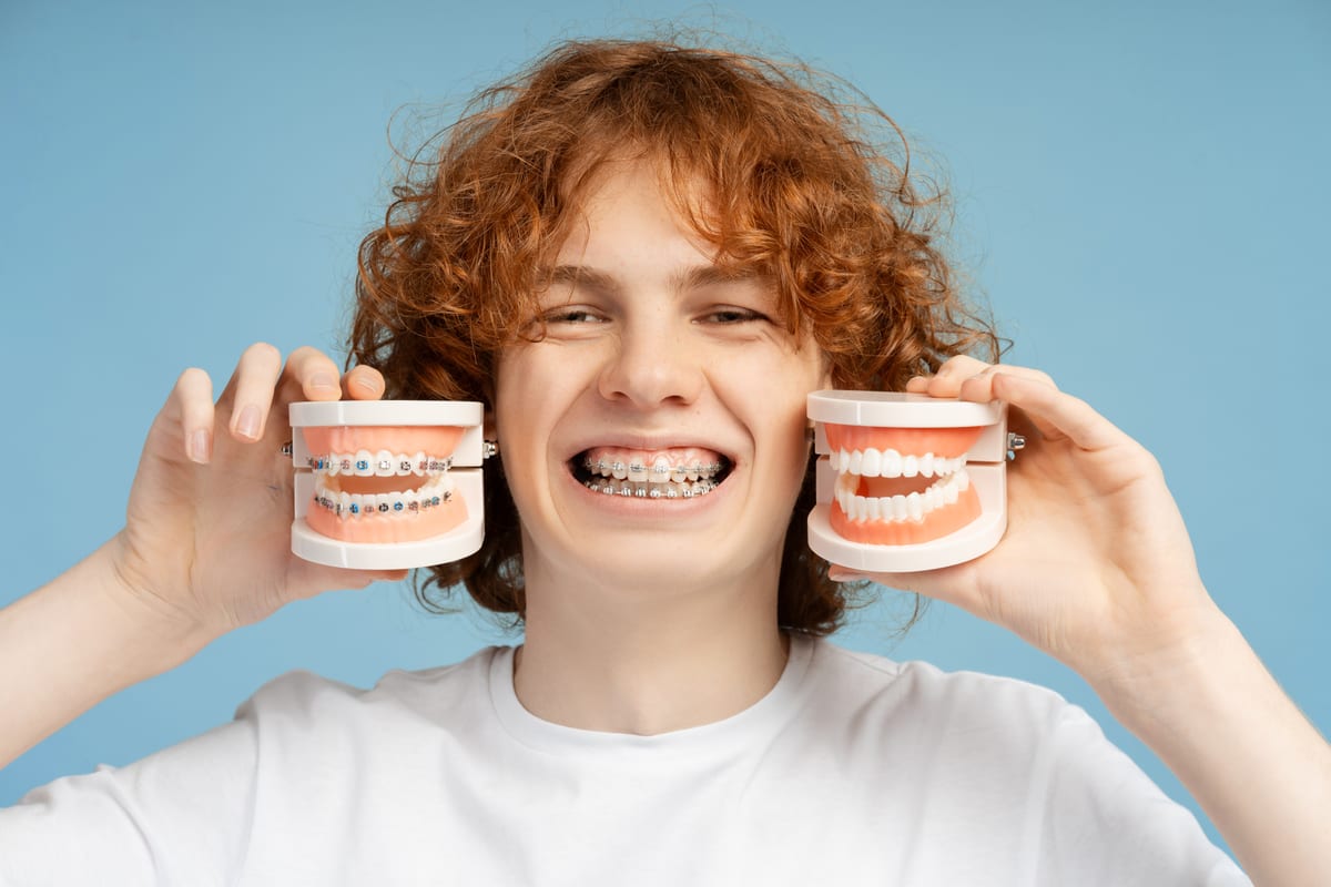 Braces in Bryan